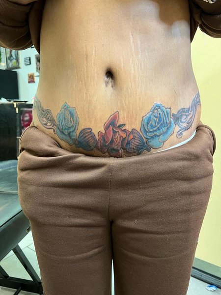 Tummy Tuck Scar Camouflage Tattoo