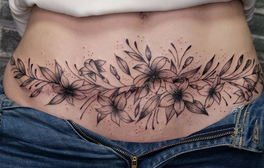 Tummy Tuck Scar Tattoo ideas