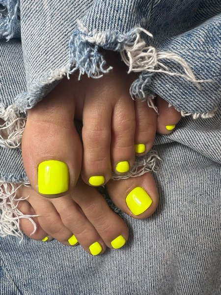 Yellow Toe Nails